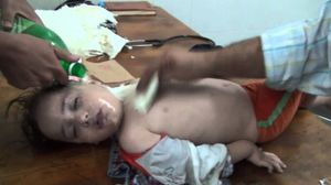 خلفت الأسلحة الكيماوية التي استخدمها النظام السوري في آب/ أغسطس الماضي آلاف الضحايا والمصابين بينهم هذه الطفلة في كفر بطنا في ريف دمشق