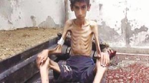 مات العشرات من الجوع بسبب حصار النظام السوري لبلدة مضايا - فيسبوك