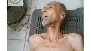 أحمد جواد توفي نتيجة الجوع والحصار في مضايا بريف دمشق- أرشيفية