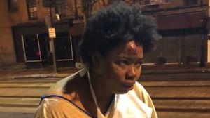 نشر أحد المشاة ويدعى "إيمامو باراكا" فيديو يظهر المرأة وهي في الشارع وترتدي ثوب مستشفى رقيق فقط- فيسبوك