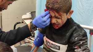 طفل فلسطيني مصاب جراء قصف الاحتلال منزله في خانيونس- المصور عزام العبادلة