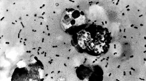 صورة مجهرية للفايروس المسبب لطاعون "الدبلي" - أرشيفية