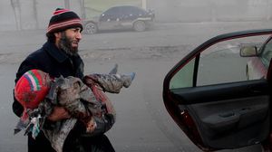 طفل جريح في القصف على حلب بالبراميل المتفجرة