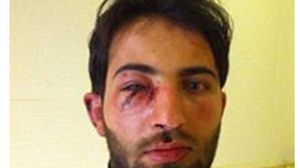 أعيد الخطيب إلى سوريا بعد تعرضه للضرب 