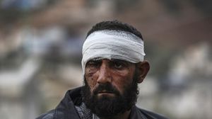 مهجر مصاب من مدينة حلب بعد وصوله للعلاج على الحدود التركية- أ ف ب
