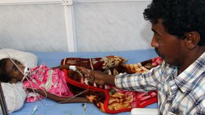 يعاني نسبة كبيرة من أطفال اليمن من سوء التغذية بسبب الحرب- أ ف ب