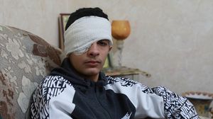 الطفل عليان تعرض لرصاصة من الاحتلال في أثناء عودتة من مدرسته بمخيم قلنديا- الأناضول
