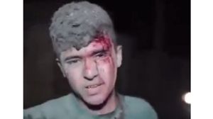 الفتى الفلسطيني الجريح توعد الاحتلال بالنصر- "إكس"