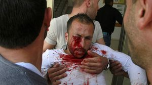 شبان فلسطينون يحملون زميلا لهم أصيب بعينه برصاص الاحتلال الإسرائيلي - أ ف ب