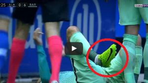 والتحم الدولي الإسباني مع أحد لاعبي ألافيس، في الدقيقة 86، قبل أن تظهر قدمه "مكسورة"- يوتوب