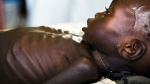 طفل يعاني من المجاعة في جنوب السودان- أ ف ب