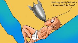 كاريكاتير نقص تغذية! اليمن