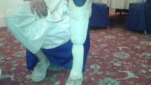 شباب يمني بترت قدمه بعد انفجار لغم شمال صنعاء - عربي 21