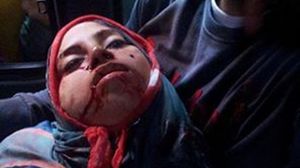 الصحفية ميادة أشرف قتلت في هجوم للأمن المصري على متظاهرين - فيسبوك