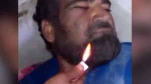 المعتقل أجبر على شرب مياه عادمة بعد حرق لحيته - يوتيوب