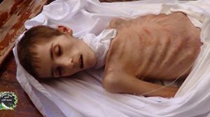 يفتك الجوع بأطفال الغوطة المحاصرة بينما يتفاهر مناصرو النظام بأطول سندويشة فلافل - أرشيفية