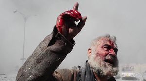 أحد العراقيين المصابين جرّاء القصف الأمريكي على منطقة المجموعة الثقافية في الموصل - يوتيوب
