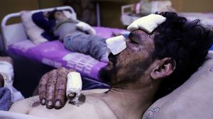 الغوطة تتعرض لمجازر بطيران ومدفعية النظام السوري وبدعم روسي- جيتي