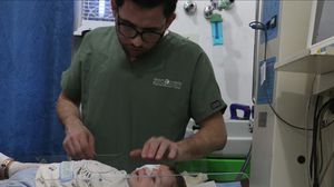 استأصل الأطباء عين الرضيع عبد الرحمن المصاب بقصف نظام الأسد- الأناضول