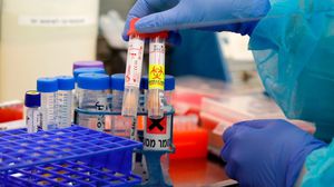 مراكز الأبحاث تسابق الزمن لإنتاج لقاح مضاد لفيروس كورونا- جيتي