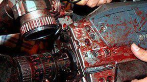 دماء على كاميرا أحد الصحفيين بعد إصابته - تعبيرية
