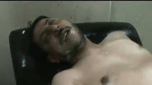 أحد المصابين بالغازات السامة في حرستا (صورة من اليوتيوب)