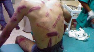 مقتل 21 شخصا جراء التعذيب في مصر - فيس بوك