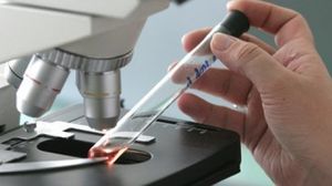 قال الباحثون إن التحولات العشوائية في الحمض النووي هي سبب السرطان - أرشيفية