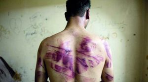 بلغ التعذيب في مصر مستويات غير مسبوقة - أرشيفية