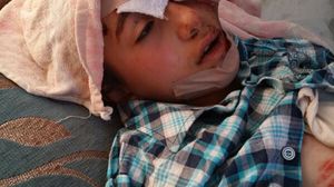 أحد الأطفال المصابين في قصف مدرسة جيل الحرية في مدينة قاح (منظومة وطن)