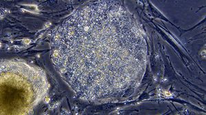 الخلايا الجذعية - أرشيفية