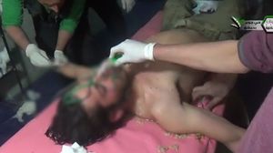 أحمد المصابين بغاز الكلور في حي جوبر الدمشقي (أرشفية)