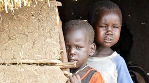 الأطفال في جنوب السودان ضحية لسوء التغذية جراء الصراع - أ ف ب