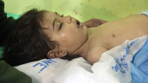 طفلة من ضحايا الهجوم الكيماوي الذي راح ضحيته أكثر من 100 سوري- أ ف ب