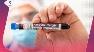 عرف العلماء فيروس "ماربورغ" لأول مرة عام 1967- عربي21