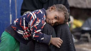معدلات سوء التغذية في اليمن تبقى من بين الأعلى في العالم، حيث يواجه أكثر من نصف السكان البالغ عددهم 33.7 مليون نسمة انعدامًا حادًّا في الأمن الغذائي- (يونيسيف)