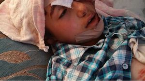 طفل مصاب نتيجة قصف طائرات النظام مدرسة جيل الحرية في بلدة قاح بريف إدلب في نيسان/ أبريل الماضي