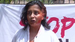 سيدة هندية تعرض جسدها لاختبارات مخبرية موجعة أمام المارة - يوتيوب