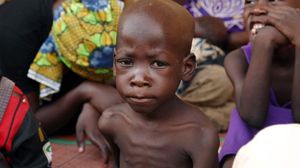 طفل يعاني سوء التغذية في مخيم للاجئين في مدينة يولا شرق نيجيريا - أ ف ب