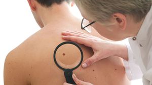 العلاج يسمح لبعض مرضى سرطان الجلد بالبقاء على قيد الحياة لأكثر من ثلاث سنوات - أرشيفية