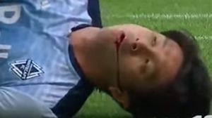 على إثر هذا الإصطدام، سقط اللاعب على أرضية الملعب وهو ينزف جراء الصدمة- يوتوب