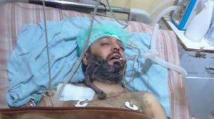 أصيب الدكتور نبيل الدعاس بنيران أطلقت من مناطق تسيطر عليها جبهة النصرة