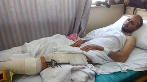 أحد الجرحى الفلسطينين يتلقى العلاج في مستشفى القوات المسلحة الأردنية في عمان