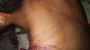 صورة نشرها حساب الرجبي تظهر آثار التعذيب على جسد الصحفي سويد- تويتر