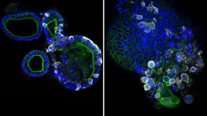 وتظهر الصور الملتقطة بمجهر عالي الدقة تكوين جزيئات فيروس كورونا المستجد (اللون الأبيض) في داخل الأمعاء البشرية- تويتر