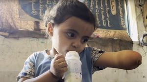 تعيش تالا مع أسرتها في ظروف معيشية صعبة، حيث يعجز والدها عن توفير الحليب والغذاء المناسب لها- وفا