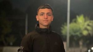 3 أطفال آخرين أصيبوا برصاص الاحتلال- إكس