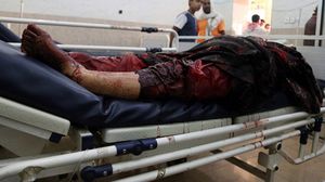المجزرة الجديدة تأتي بعد يومين من قصف استهدف سوقا شعبية في تعز أسفر عن مقتل 10 مدنيين - أ ف ب