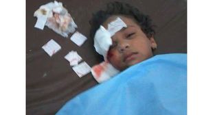 طفلة جريحة جراء قصف قوات حفتر لمدينة درنة ـ عربي21