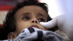 أصبح اليمن بؤرة لمرض الكوليرا بسبب الحرب الدائرة - أ ف ب